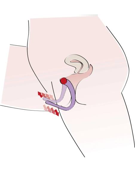 Intim Spreader - lila